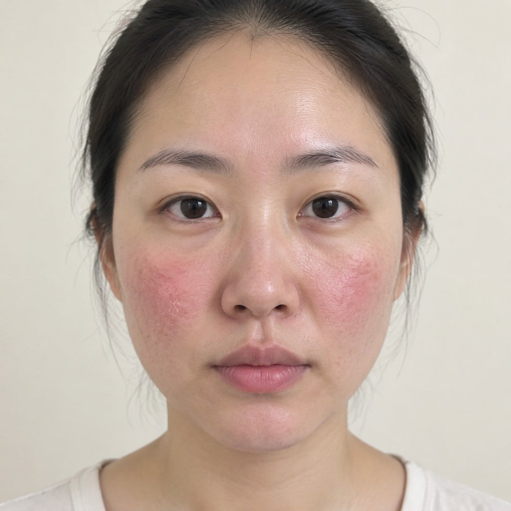 使用前效果示意