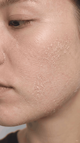 From dry and tight to comfortably hydrated