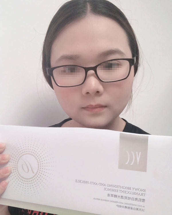 VCC 亮白祛斑精萃液 买家秀实拍：买家手持产品盒实拍